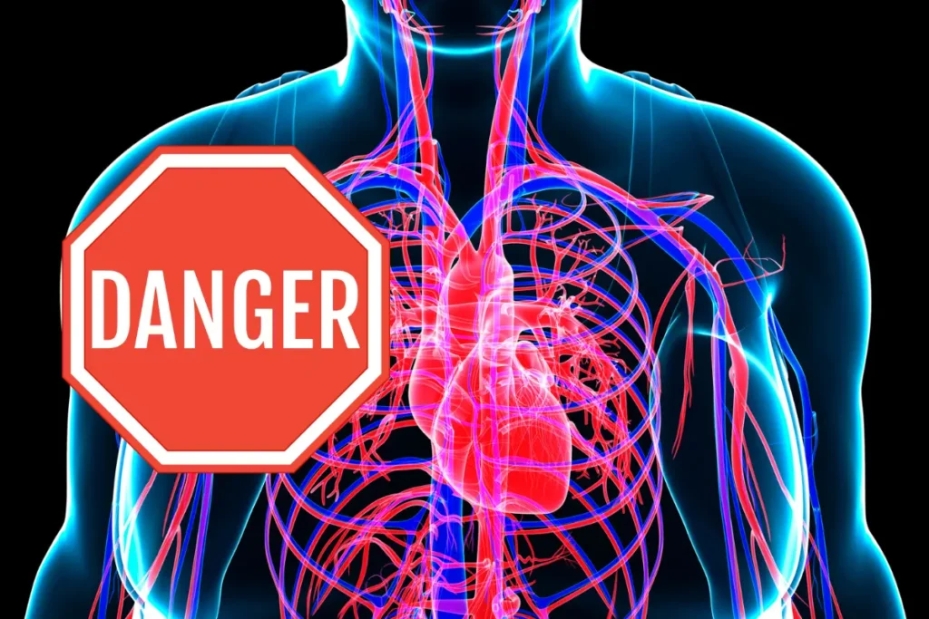 risque cardiovasculaire